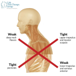 Upper-Crossed-Syndrome-1.png
