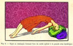 800px-Catalepsie_catalepsy_hypnosis_1941..jpg