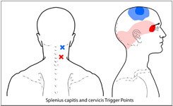 splenius-group.jpg