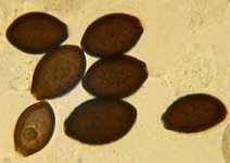 220px-Panaeolus_castaneifoliusspores.jpg