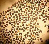 167px-Panaeolus_subbalteatusspores.jpg