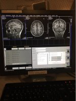 Brain+fMRI.jpg